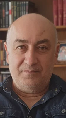 Hair Transplant - Before