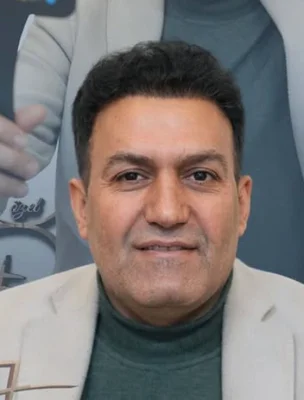 After — Hair Transplant