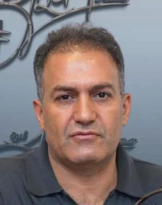 Before — Hair Transplant