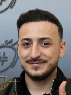 After — Hair Transplant